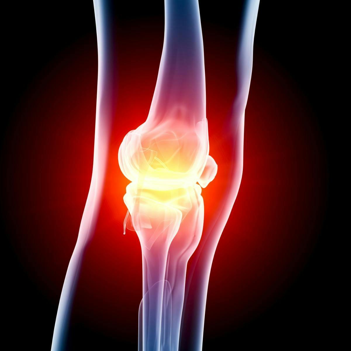 First Evidence that NEM Eggshell Membrane May Protect Joints (Rat Study)