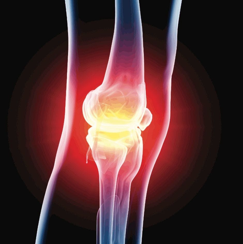 UC-II Collagen Improves Joint Function in Healthy Subjects, New Study Shows