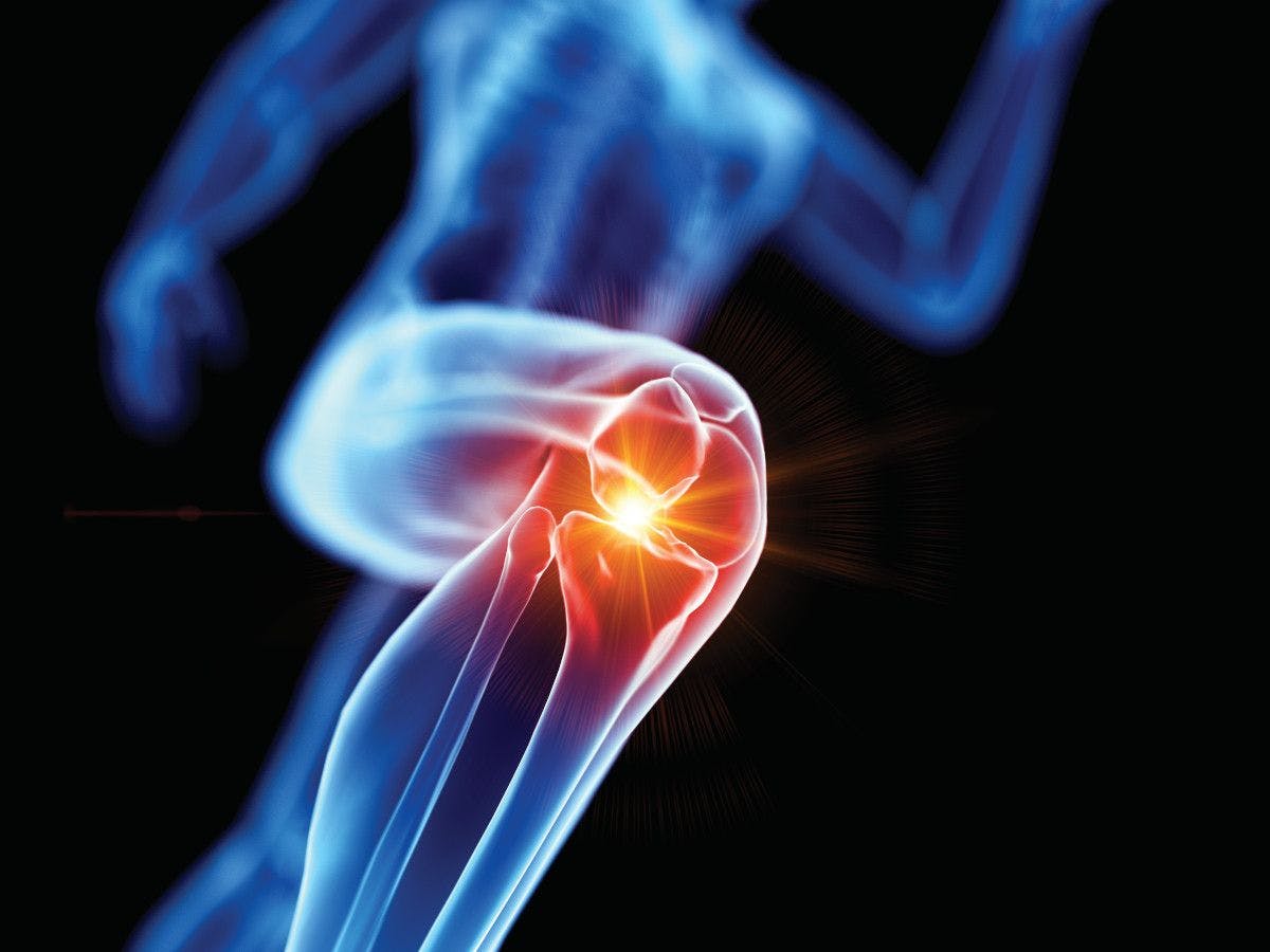 x-ray body in motion, with focus on knee, highlighted in orange. 