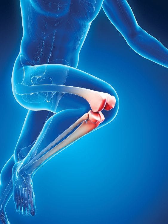 illustration of running legs highlighting the knee joint