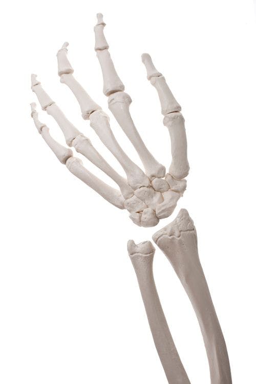 Greater Calcium, Vitamin D Intake Could Save Billions in Healthcare Costs from Bone Fractures