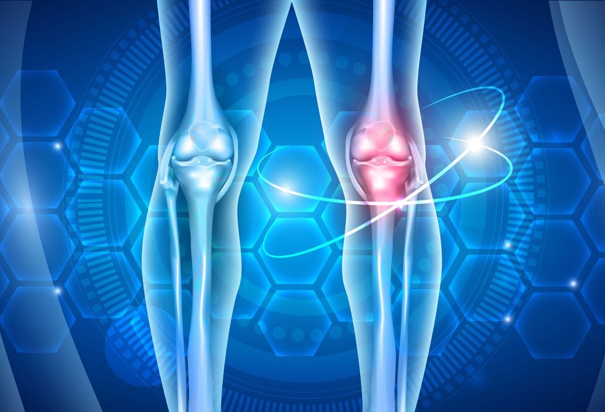illustration of knees and the joints in them