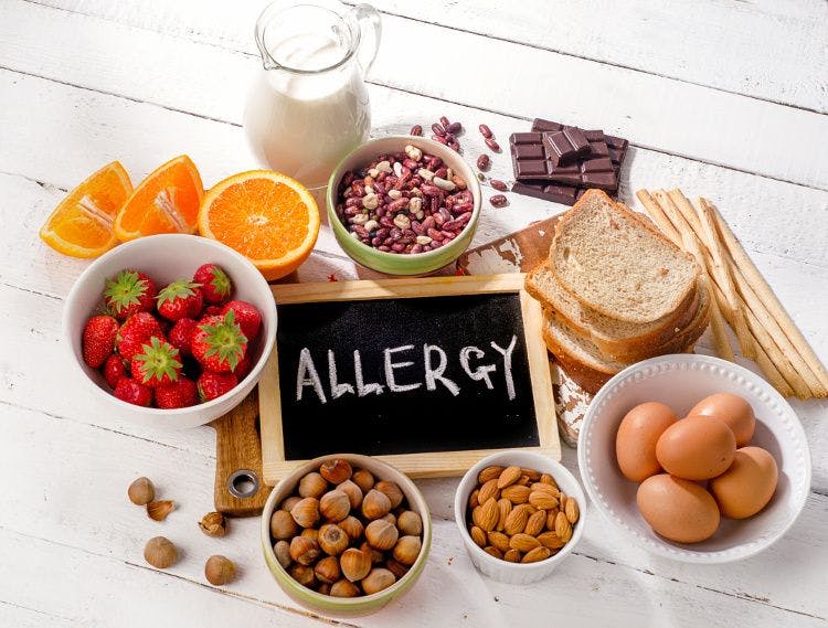 Snack aisle: Allergen-free, gluten-free snacks are huge