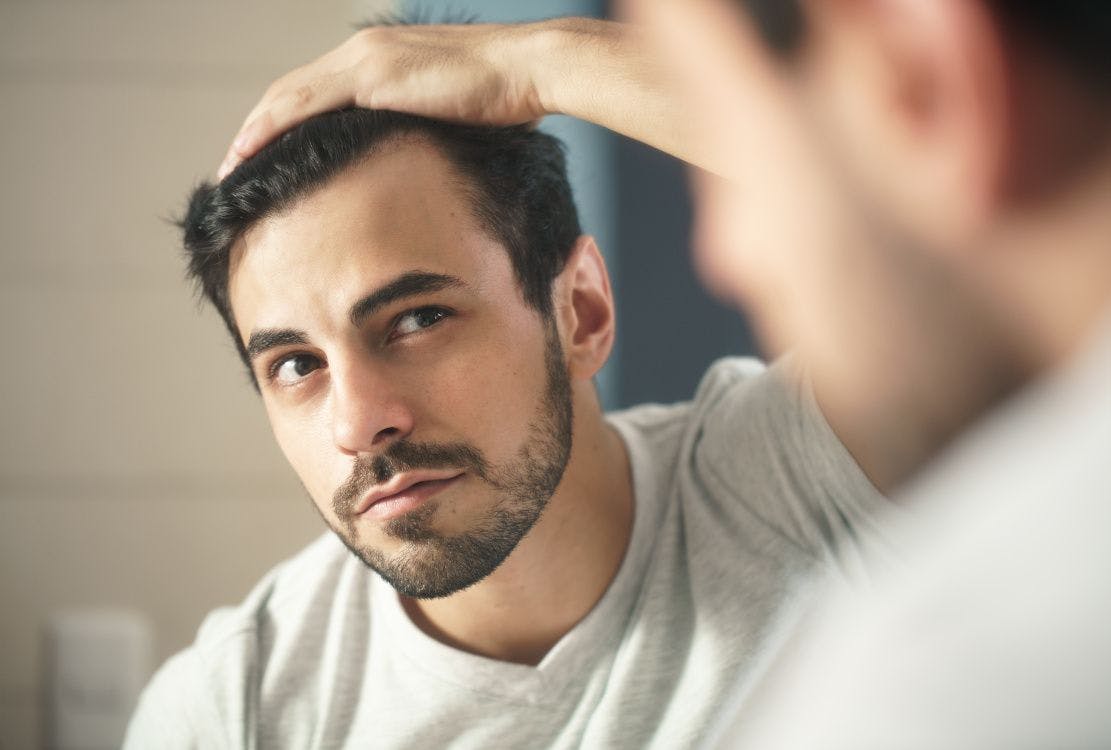 man looking at hairline in mirror